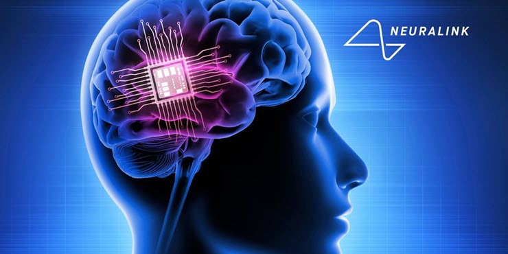 Neuralink đã cấy ghép chip não cho bệnh nhân thứ hai